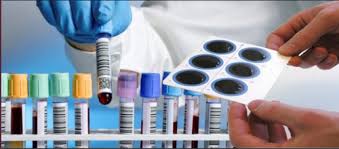 Serology labs