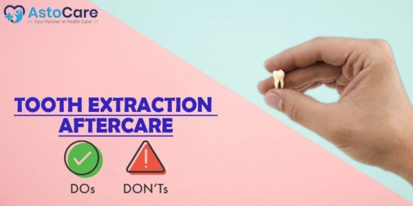 Tooth Extraction Aftercare Do’s and Don’ts